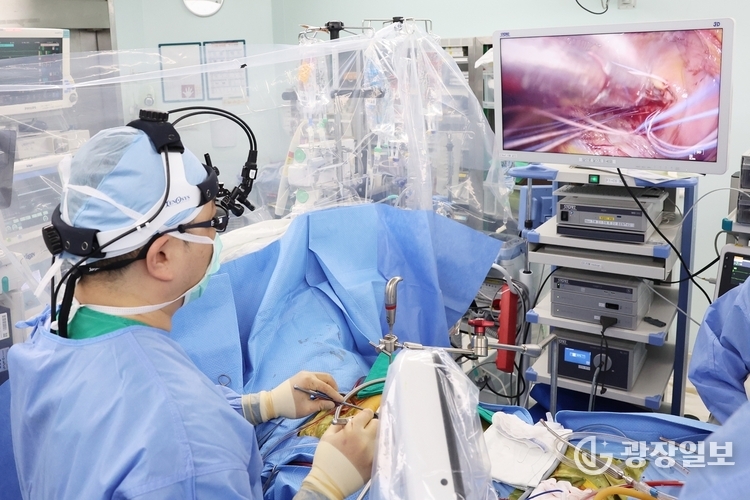 서울아산병원 심장혈관흉부외과 유재석 교수가 3D완전내시경을 이용한 심장수술을 하고있다