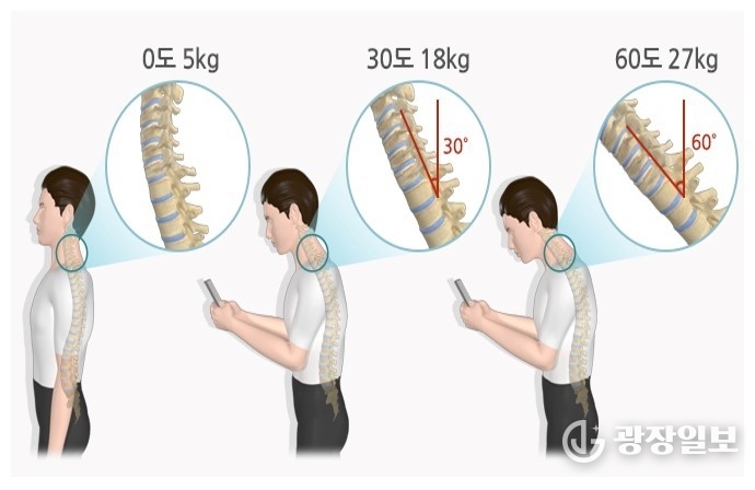 고개를 숙이는 각도에 따라 목 디스크에 걸리는 압박 정도 (출처: 질병관리청 건강정보포털)